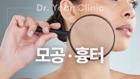 모공 흉터 썸네일