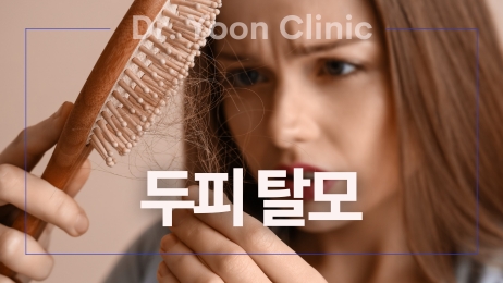 두피 탈모 썸네일